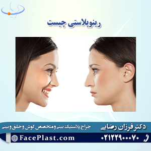 رینوپلاستی چیست