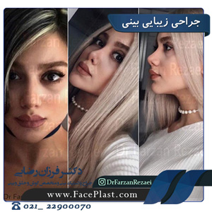 عمل بینی
