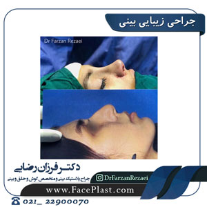 جراحی بینی