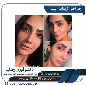 جراحی زیبایی بینی