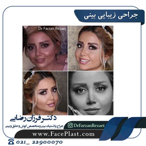 جراحی زیبایی بینی