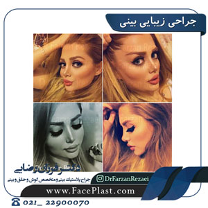 جراحی زیبایی بینی