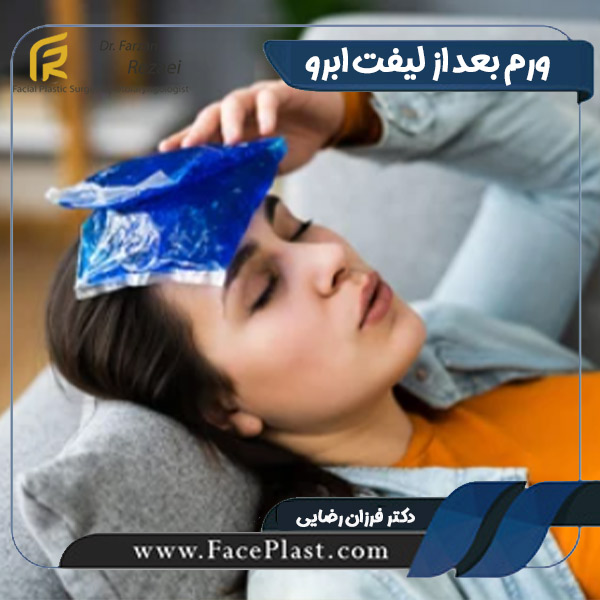 ورم بعد از لیفت ابرو - دکتر فرزان رضایی