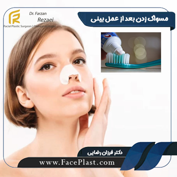 مسواک زدن بعد از عمل بینی - دکتر فرزان رضایی