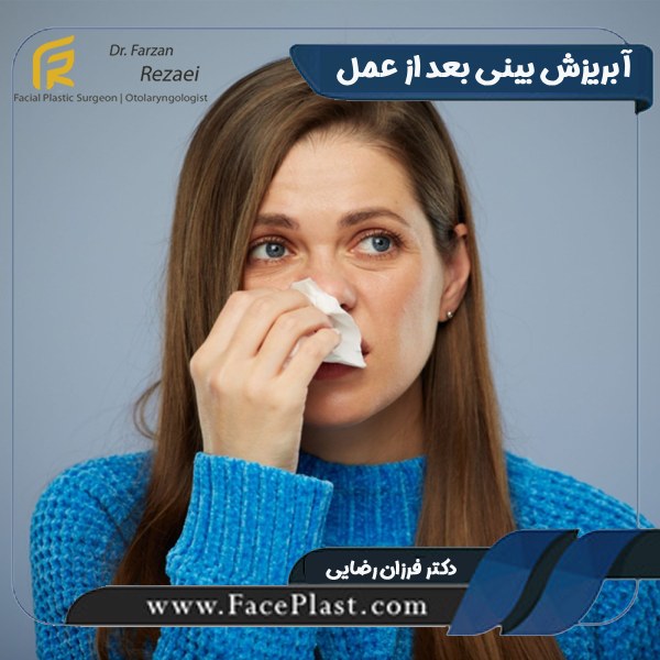 آبریزش بینی بعد از عمل