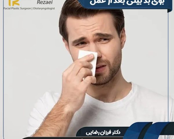 بوی بد بینی بعد از عمل