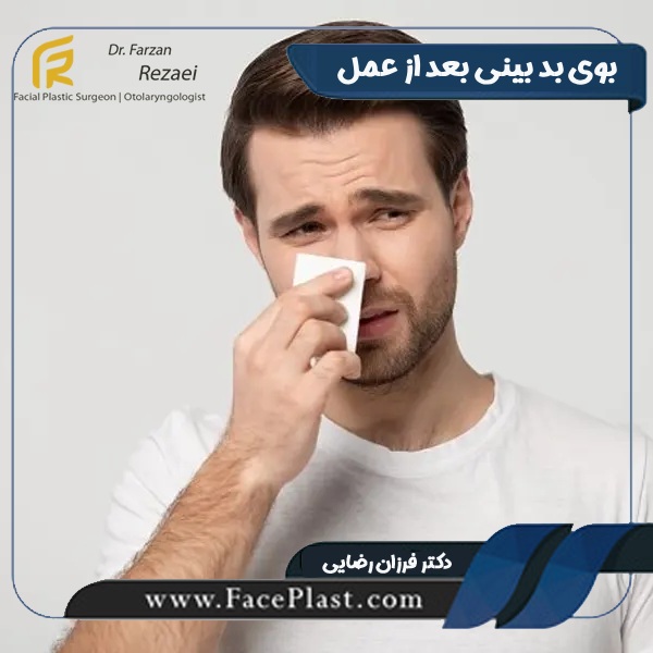 بوی بد بینی بعد از عمل