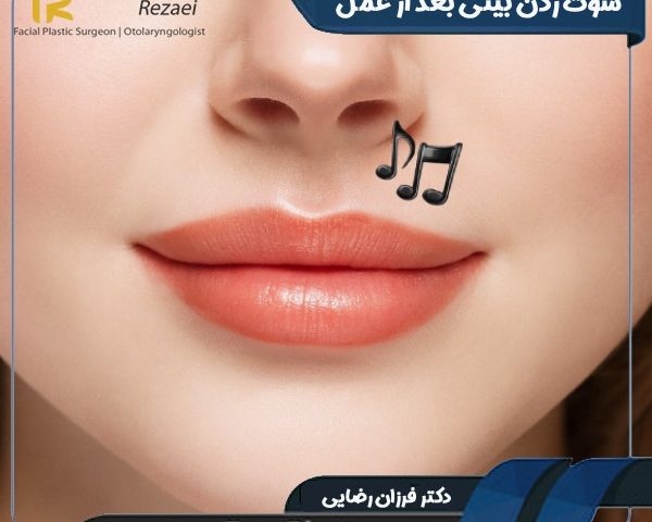 سوت زدن بینی بعد از عمل