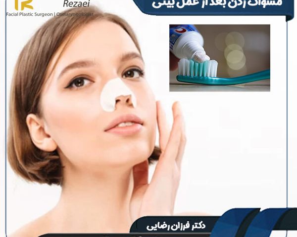 مسواک زدن بعد از عمل بینی - دکتر فرزان رضایی