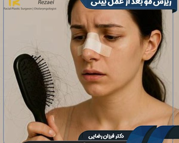 ریزش مو بعد از عمل بینی