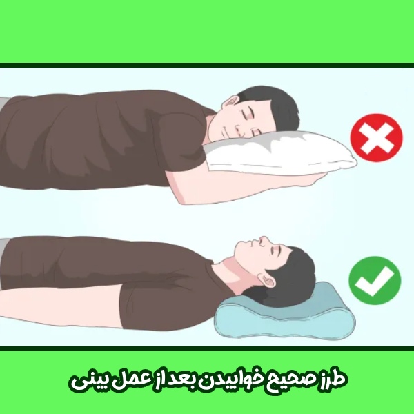 طرز صحیح خوابیدن بعد از عمل 