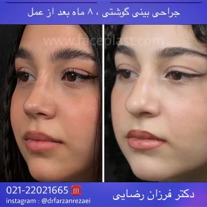 pic-rhinology-01-2