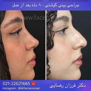 pic-rhinology-01-3