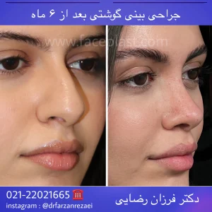 pic-rhinology-010-2