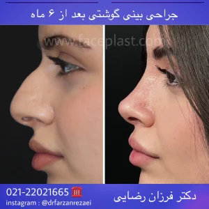 pic-rhinology-010-3