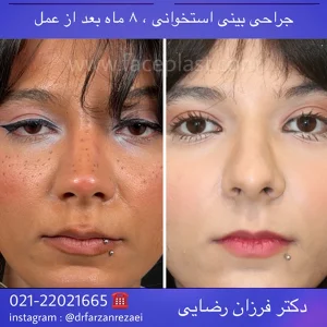 pic-rhinology-03-1