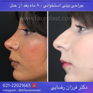 pic-rhinology-03-3