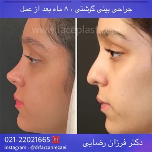 pic-rhinology-04-3