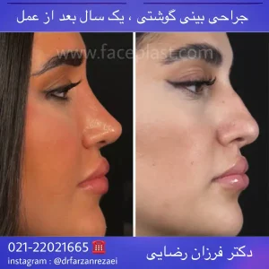 pic-rhinology-05-3