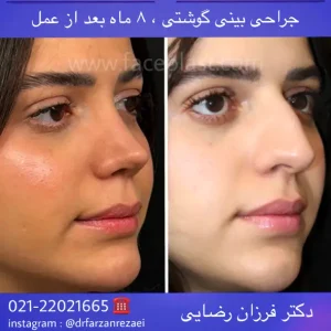 pic-rhinology-06-2