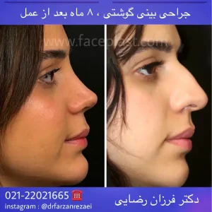 pic-rhinology-06-3