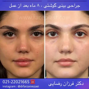 pic-rhinology-07-1