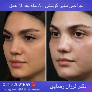 pic-rhinology-07-2