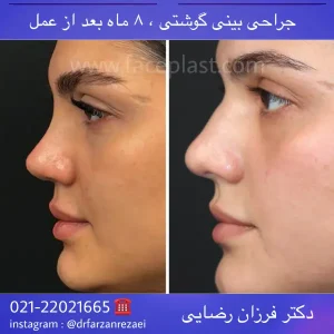 pic-rhinology-07-3
