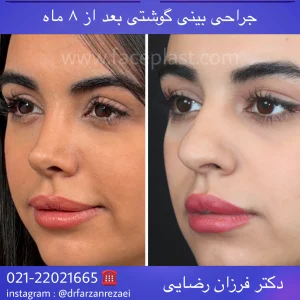pic-rhinology-08-2