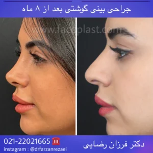 pic-rhinology-08-3