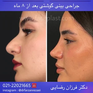 pic-rhinology-09-3