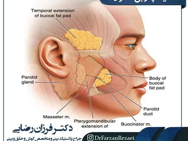 تخلیه چربی صورت