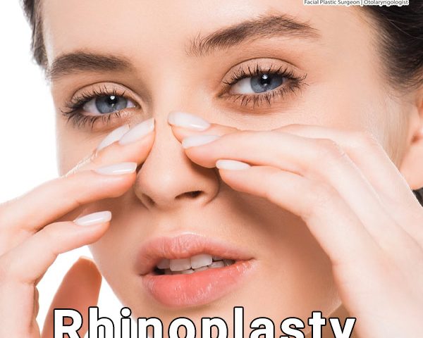 Rhinoplasty - Dr. Farzan Rezaei