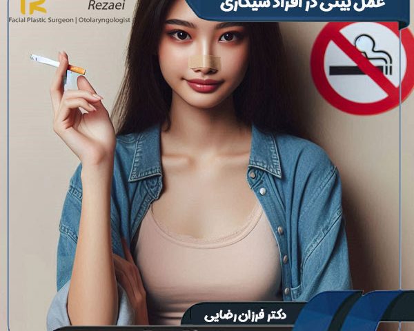 عمل بینی در افراد سیگاری - دکتر فرزان رضایی - faceplast.com