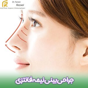 جراحی بینی نیمه فانتزی - دکتر فرزان رضایی